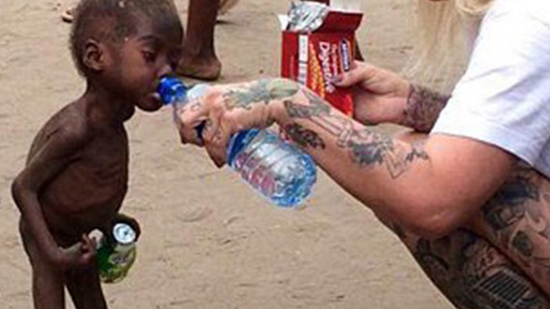 Imagenes Niños De Africa En Desnutricion Cómo está hoy Hope, el niño desnutrido rescatado en África hace un año -  Infobae