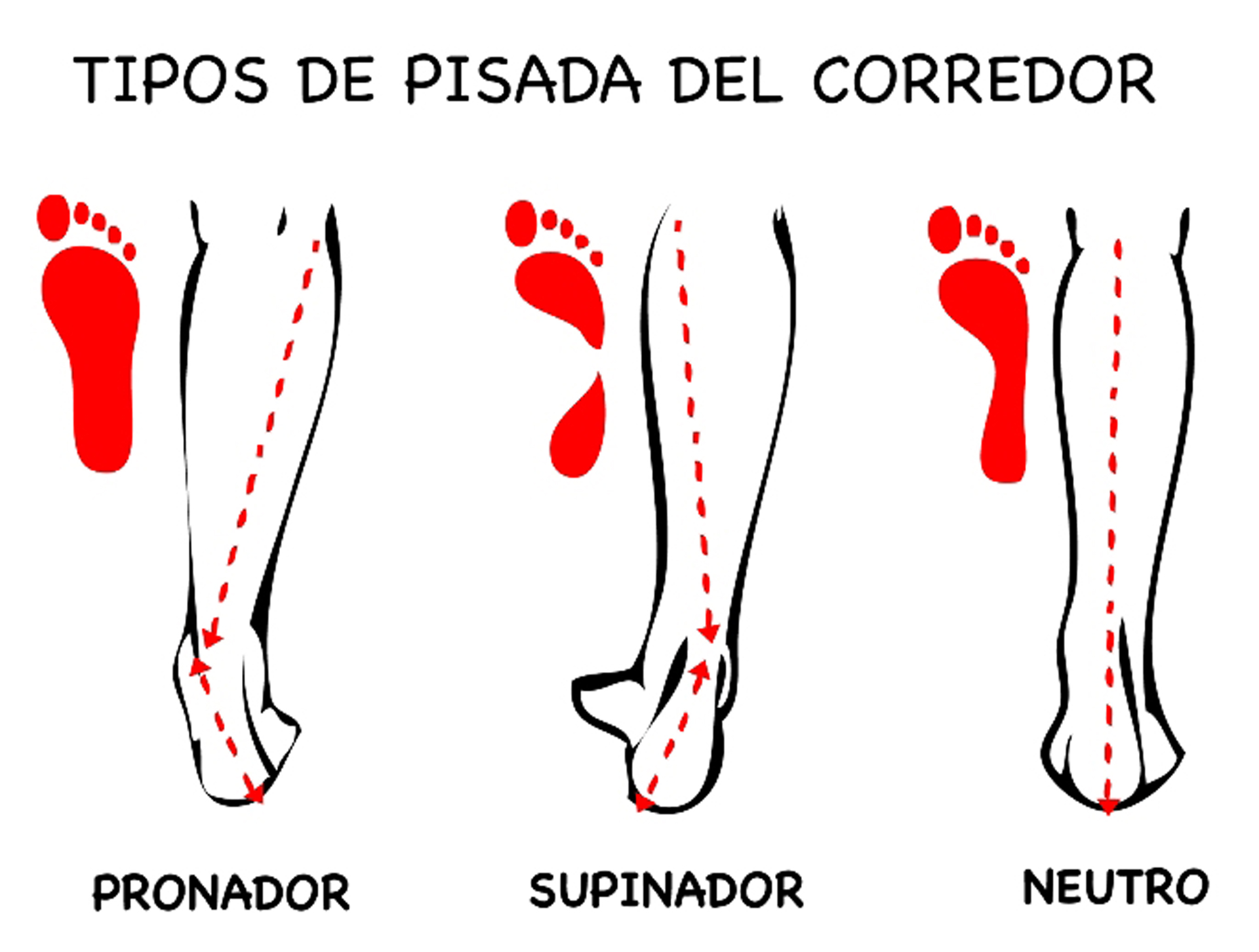 Los tipos de pisada, cómo se desvía la pierna