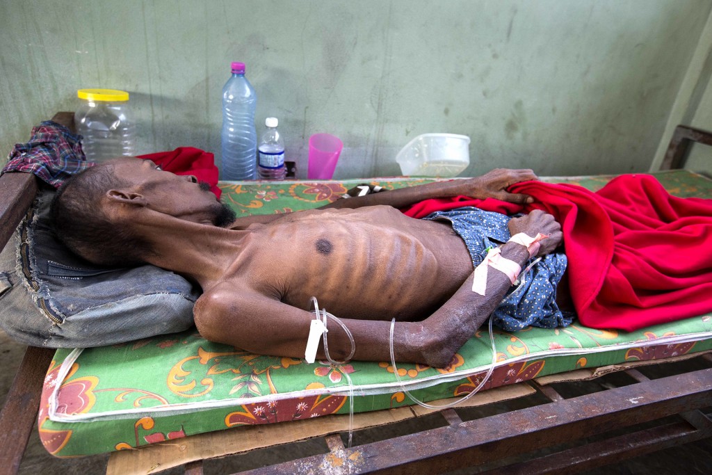 Un prisionero demasiado débil para mantenerse parado. Las muertes por las pobres condiciones de vida van en aumento (AP)