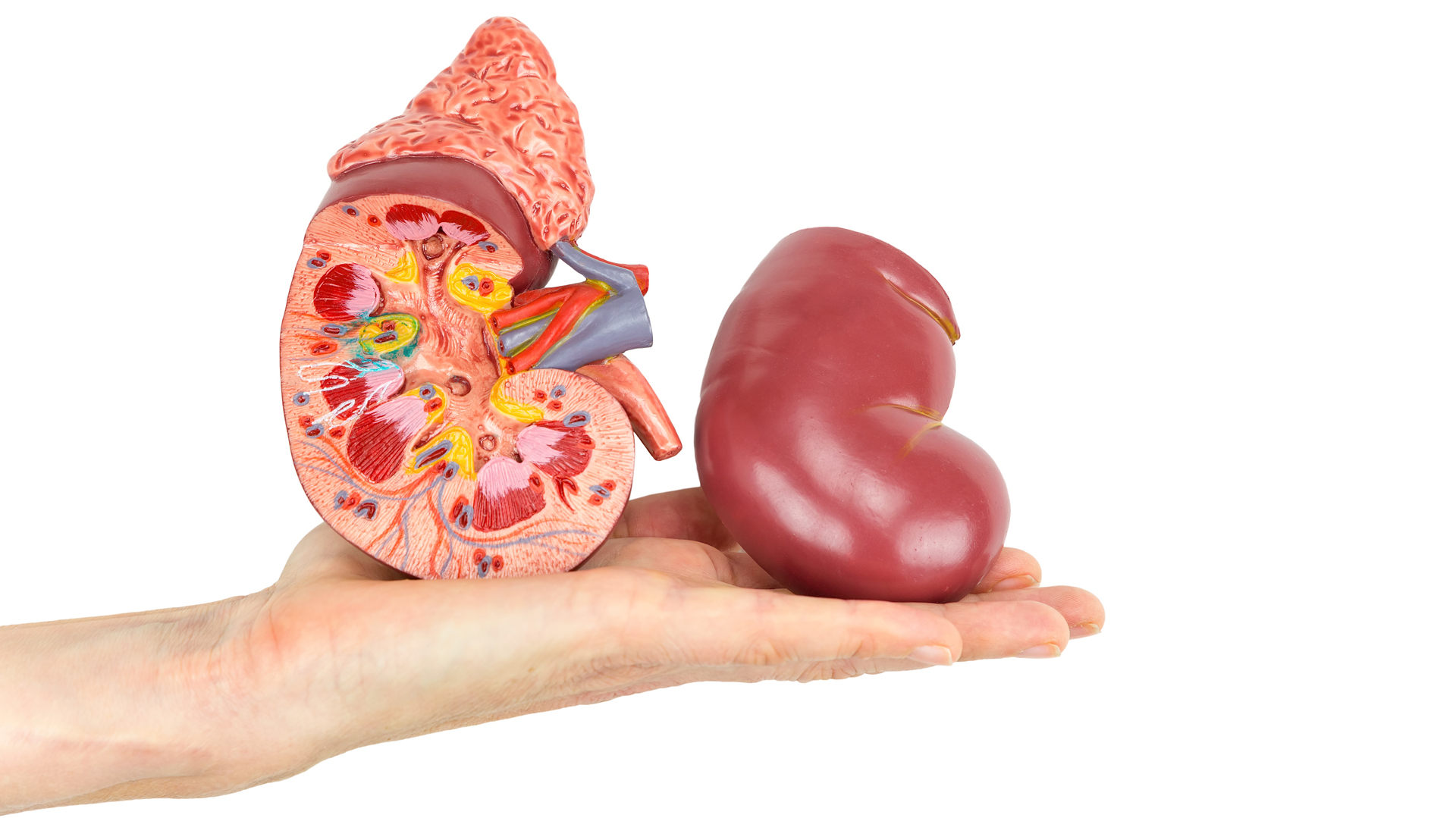 De todas las causas que llevan a la enfermedad renal crónica, la diabetes es una de las causas más frecuentes (iStock)