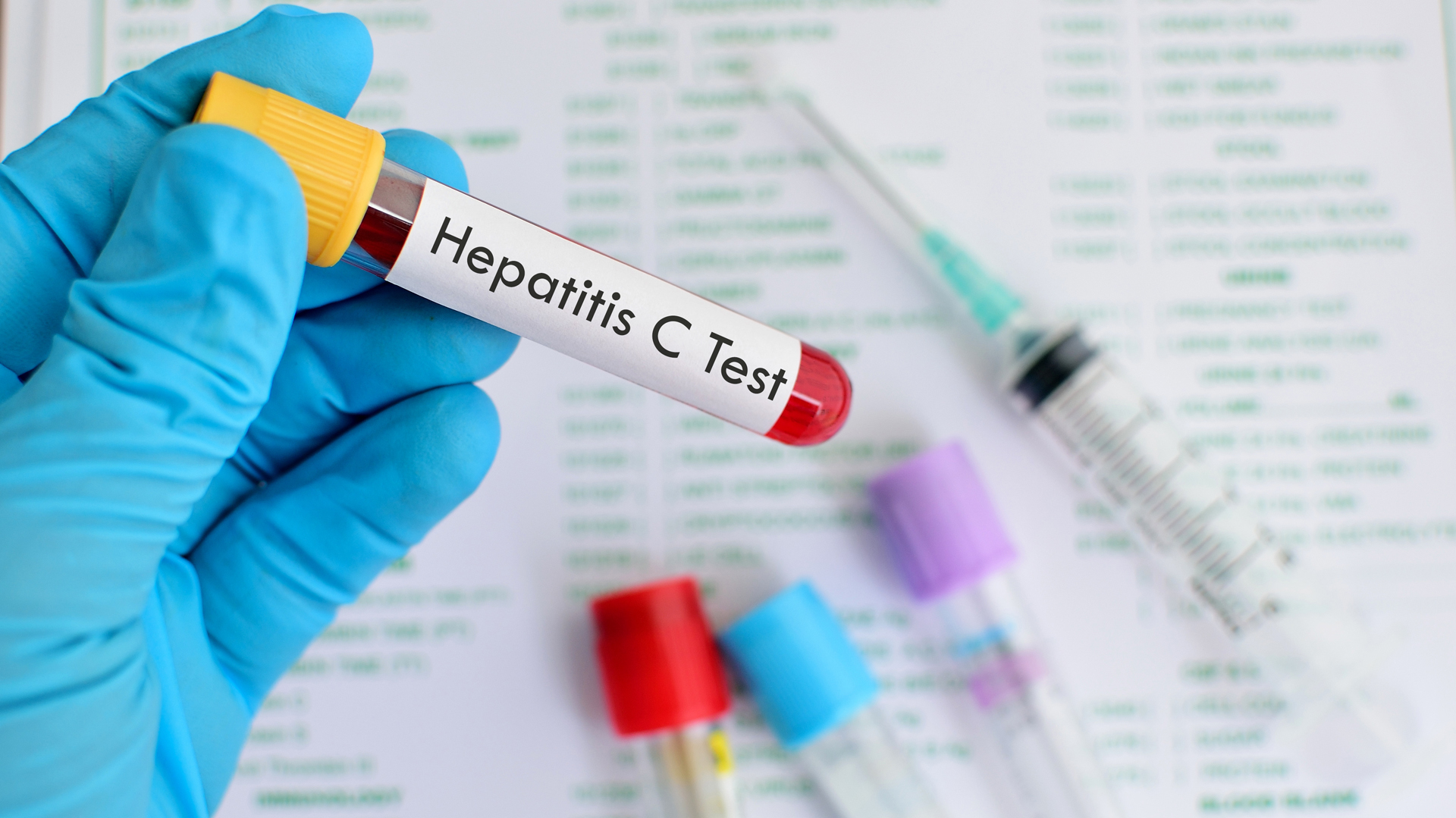Ya hay medicamentos para tratar y curar la hepatitis C (iStock)