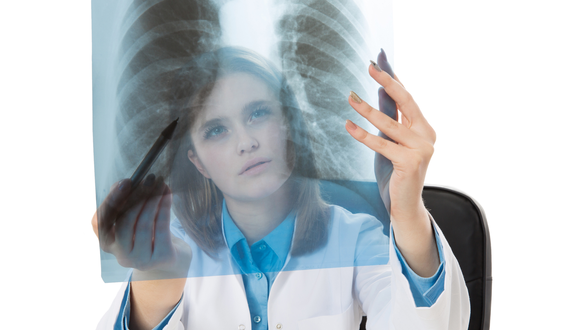 La enfermedad causa más muertes que el cáncer de colon, mama y próstata juntos (iStock)