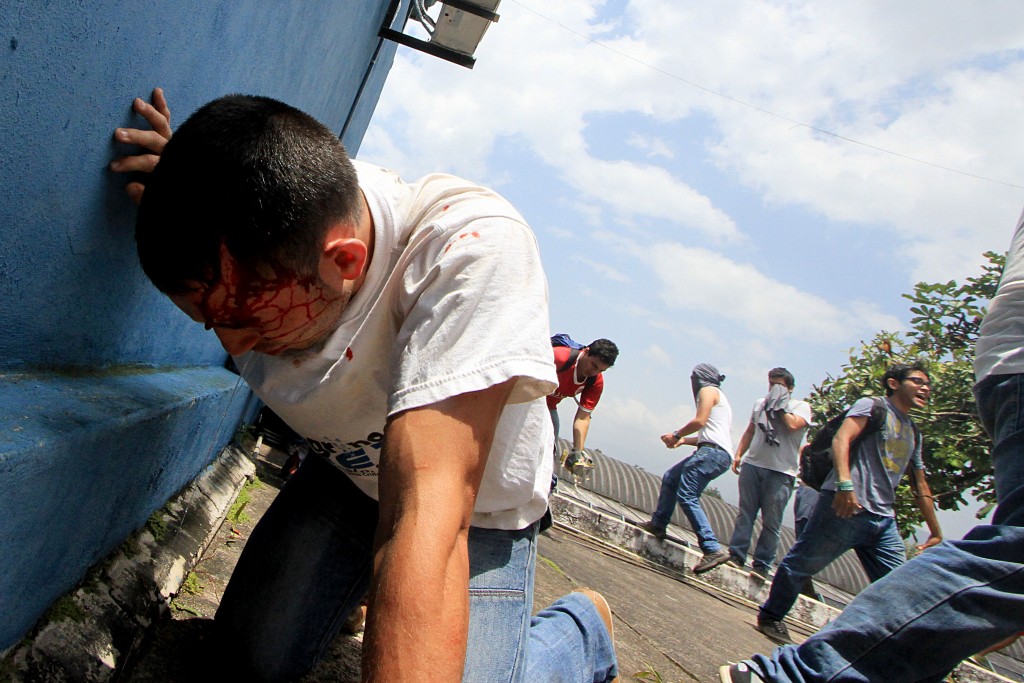 Un manifestante herido en San Crisóbal (AFP)