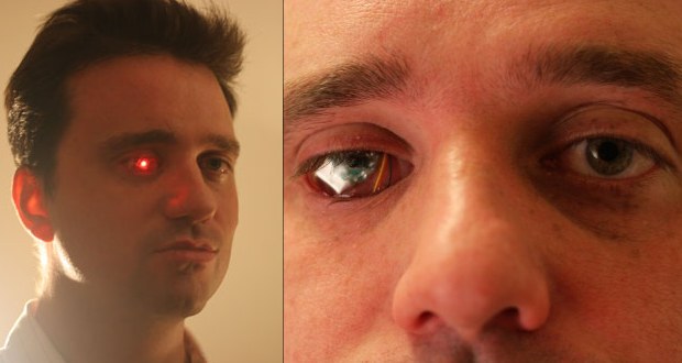 El dispositivo que tiene en el ojo le permite grabar y, a la vez, transmitirlo a un monitor (Eyeborg Project)