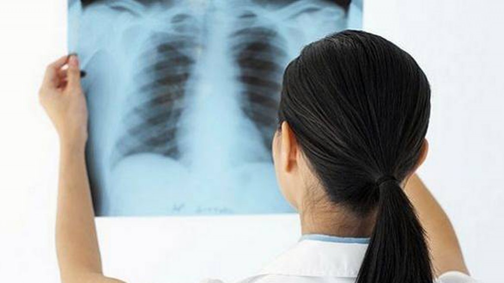 Esta enfermedad crónica no tiene cura (iStock)