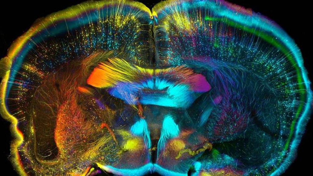 Visión psicodélica del cerebro durante el consumo de LSD (M.B.)