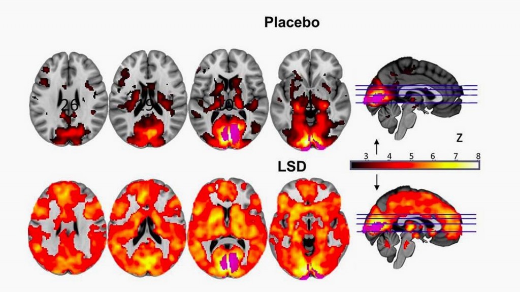 Los científicos observaron una serie de cambios en el cerebro con la ingesta de esta sustancia (M.B.)