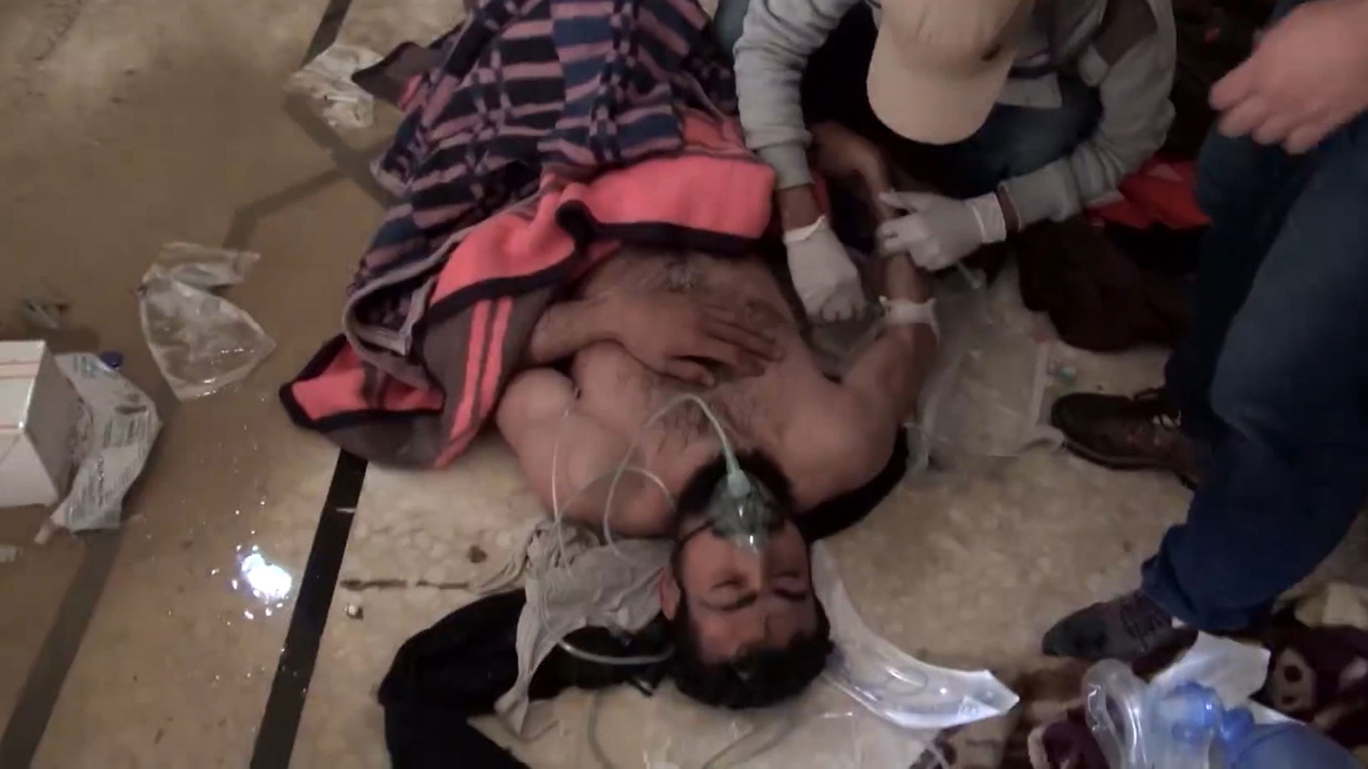 Víctima de un reciente ataque químico en Siria