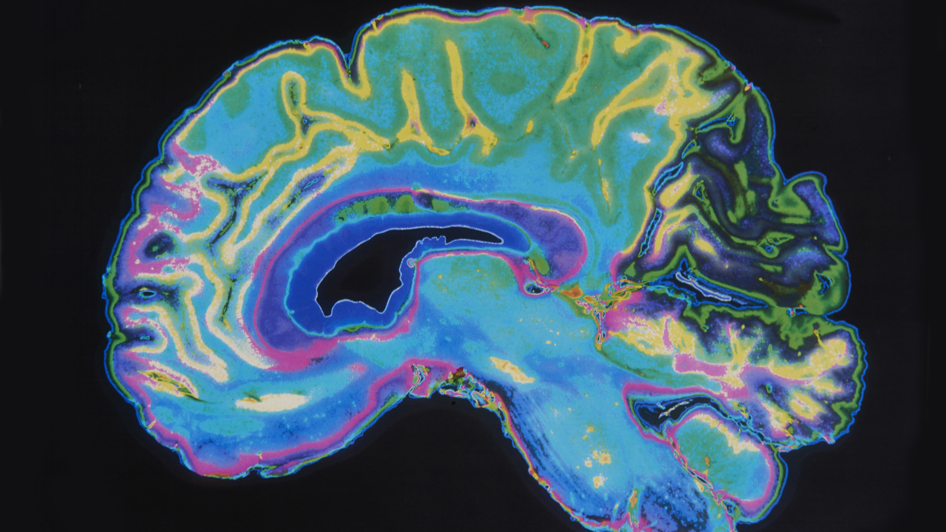 Con hábitos saludables es posible mantener una buena salud cerebral a medida que pasan los años (iStock)