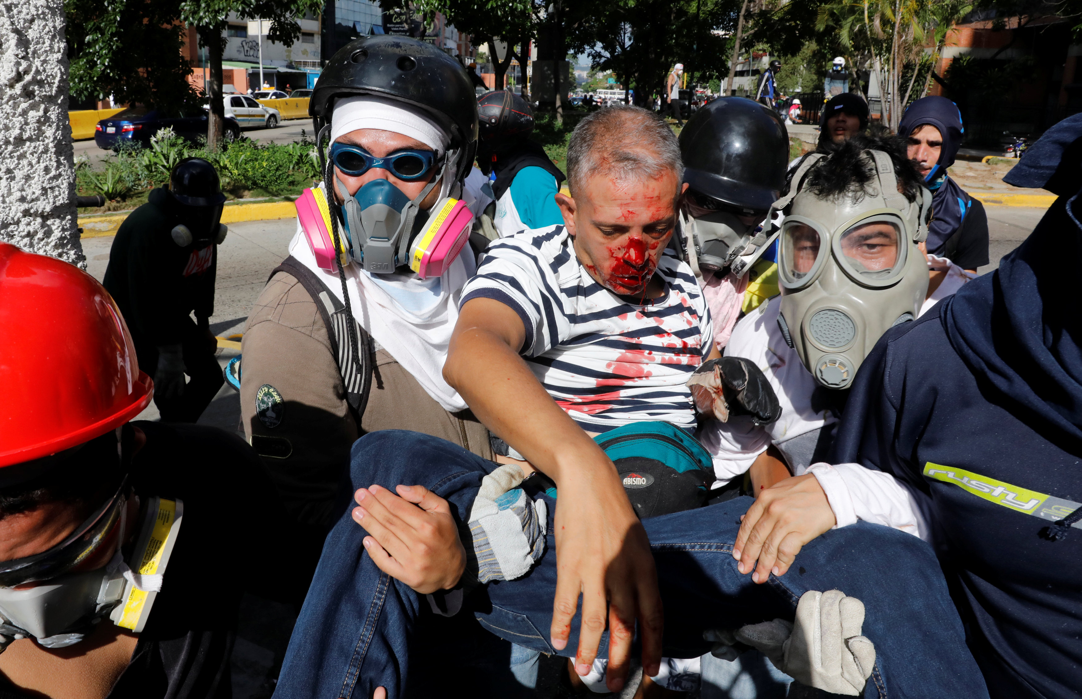 Manifestante herido por la represión del régimen militar en Caracas (Reuters)