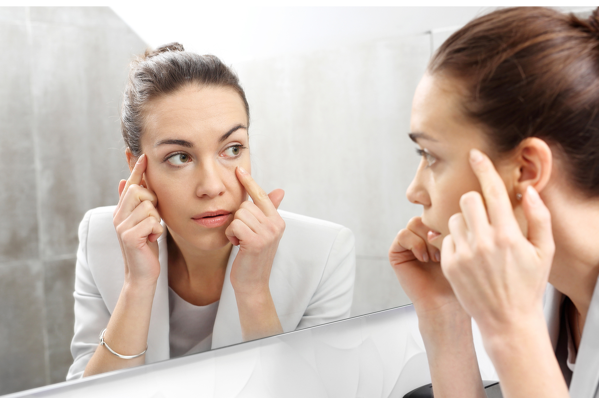 Las ojeras no tienen relación directa con la falta del sueño