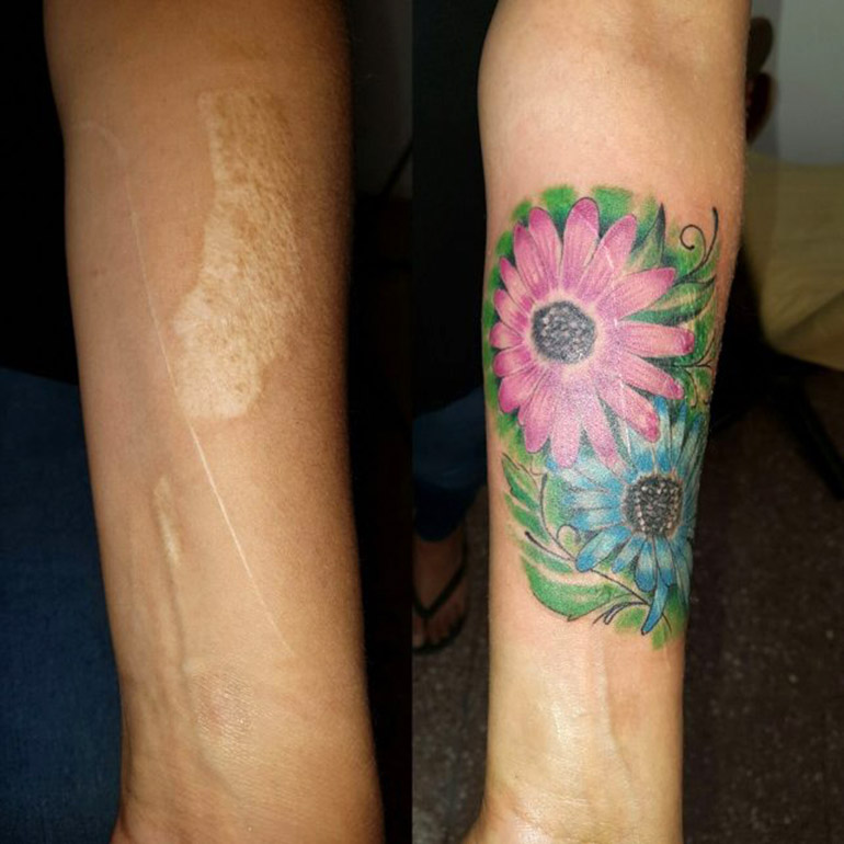 El primer tatuaje, sobre una quemadura hecha con agua hirviendo