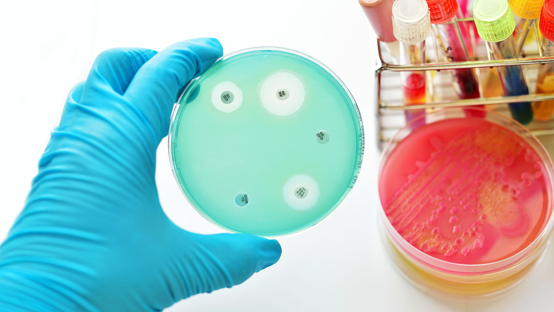 Las infecciones por multirresistencia son un mal creciente (iStock)
