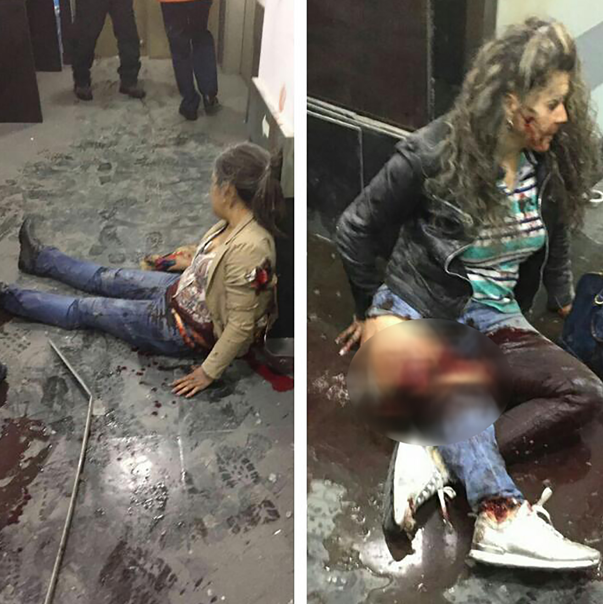 Personas heridas tras la explosión. (@demokrato)