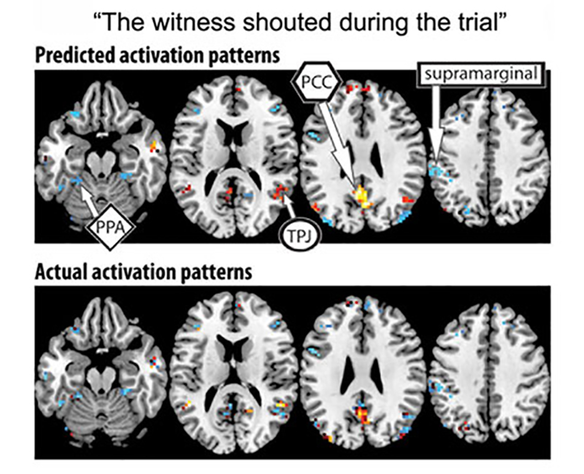 Los significados de los pensamiento son procesado por un área determinada del cerebro (Universidad Carnegie Mellon)