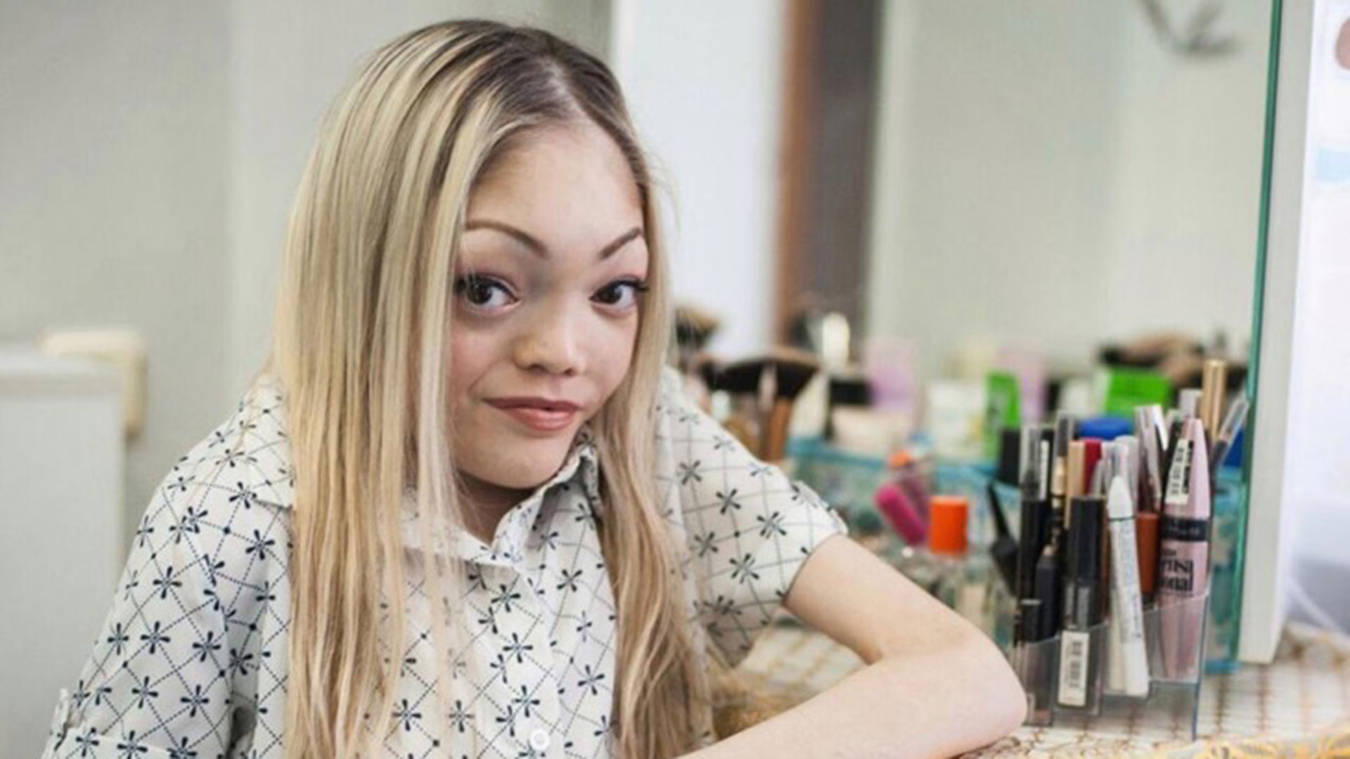 La Youtuber experta en maquillaje que sufrió bullying durante años por su enfermedad - Infobae La Youtuber experta en maquillaje que sufrió bullying durante años por su enfermedad - Infobae