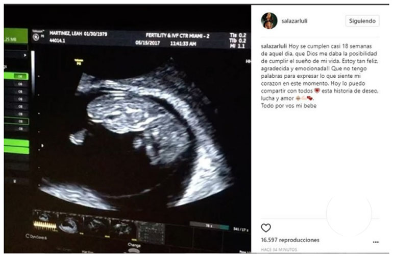 Captura de Instagram de la ecografía del bebé de Luciana Salazar