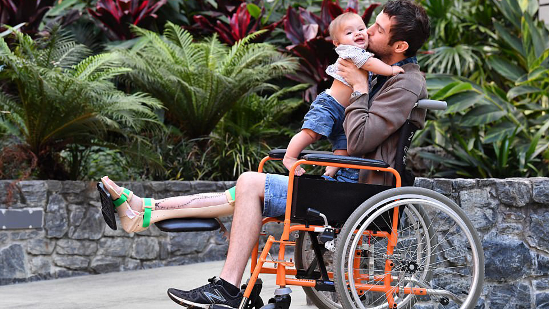 Los doctores esperan que en 18 meses el paciente pueda volver a su vida cotidiana.