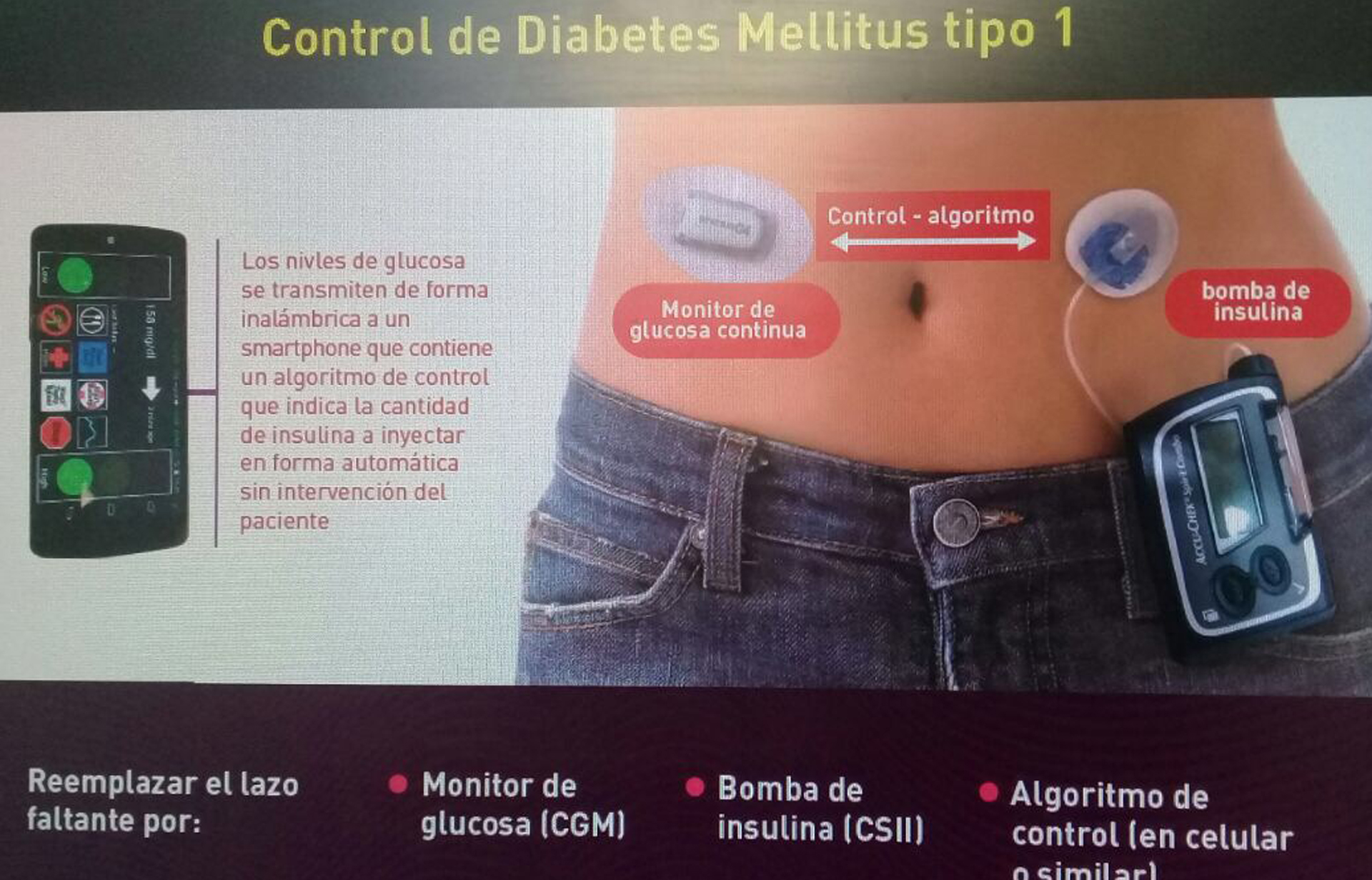 El sistema inyecta automáticamente la cantidad de insulina que la persona necesita en cada momento