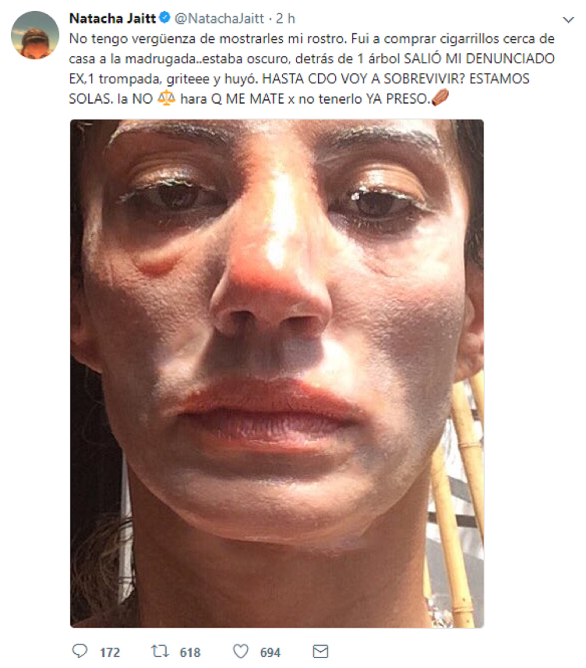 Natacha Jaitt cuando denunció violencia de género de su ex pareja