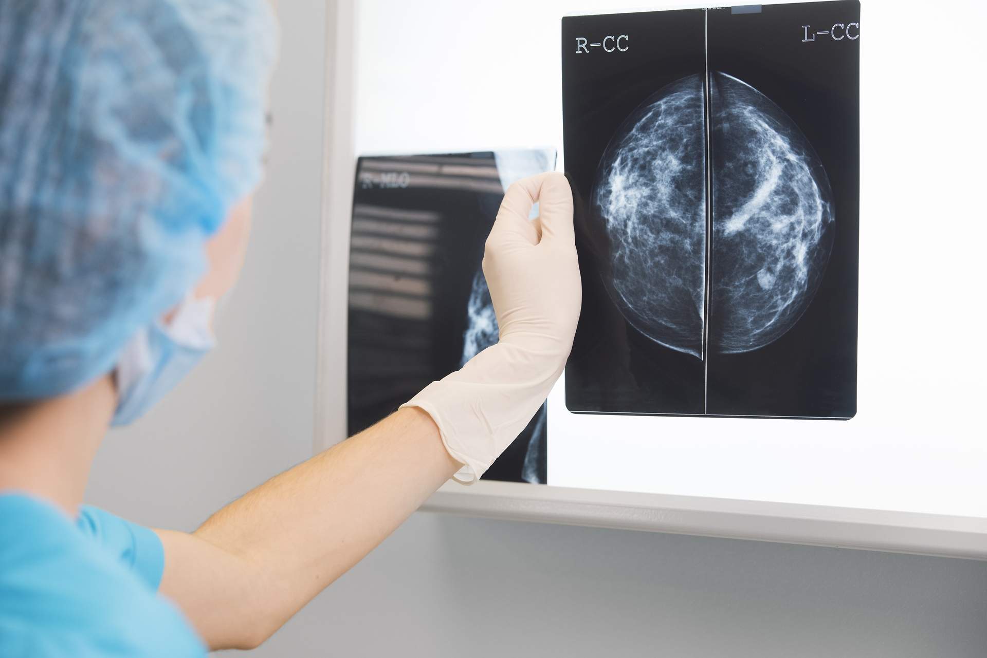 Existe hoy en día una protección contra rayos muy alta, por lo que la dosis de radiación que reciben las pacientes en el estudio es muy baja, y permite detectar lesiones de un pequeño tamaño que hacen que el cáncer de mama realmente sea curable (Getty Images)