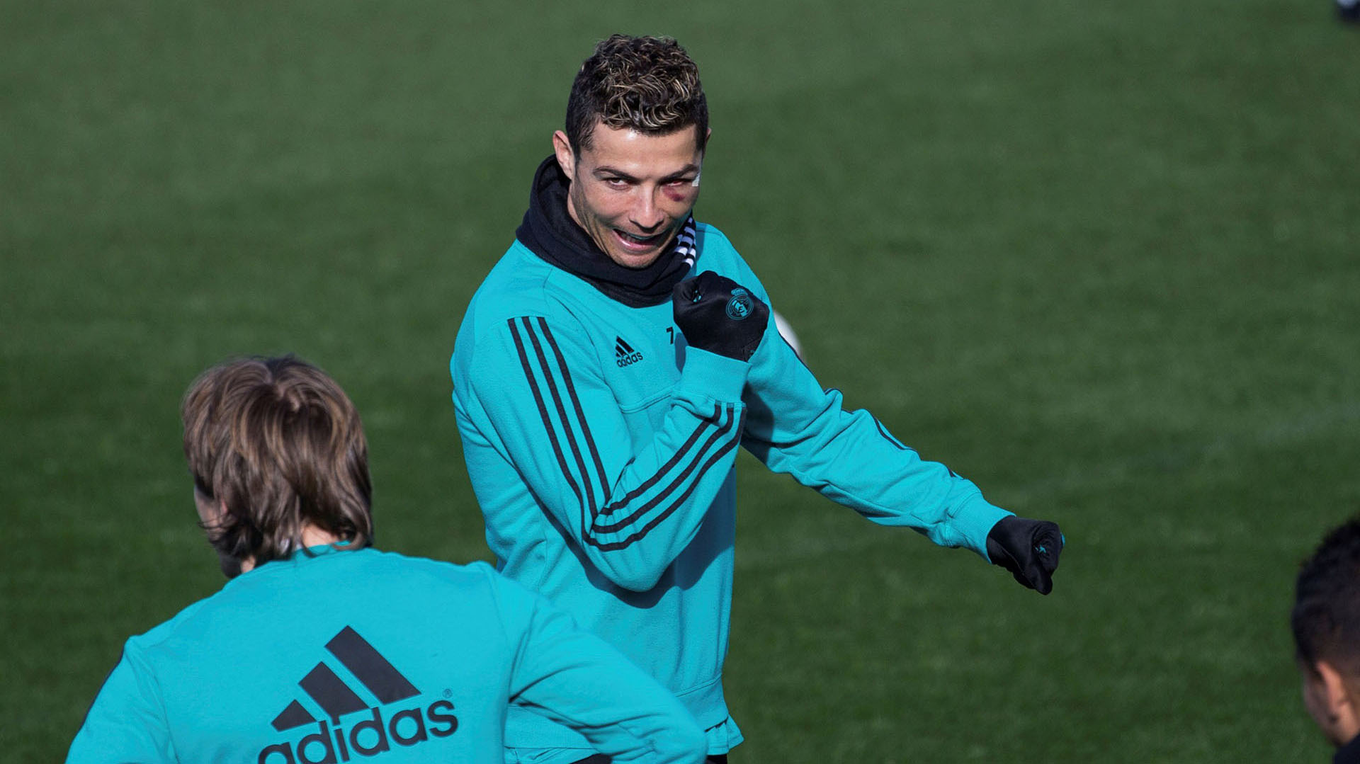 Cristiano Ronaldo sufrió una patada en la cara partido que el Real Madrid se impuso por 7 a 1 ante el Deportivo La Coruña