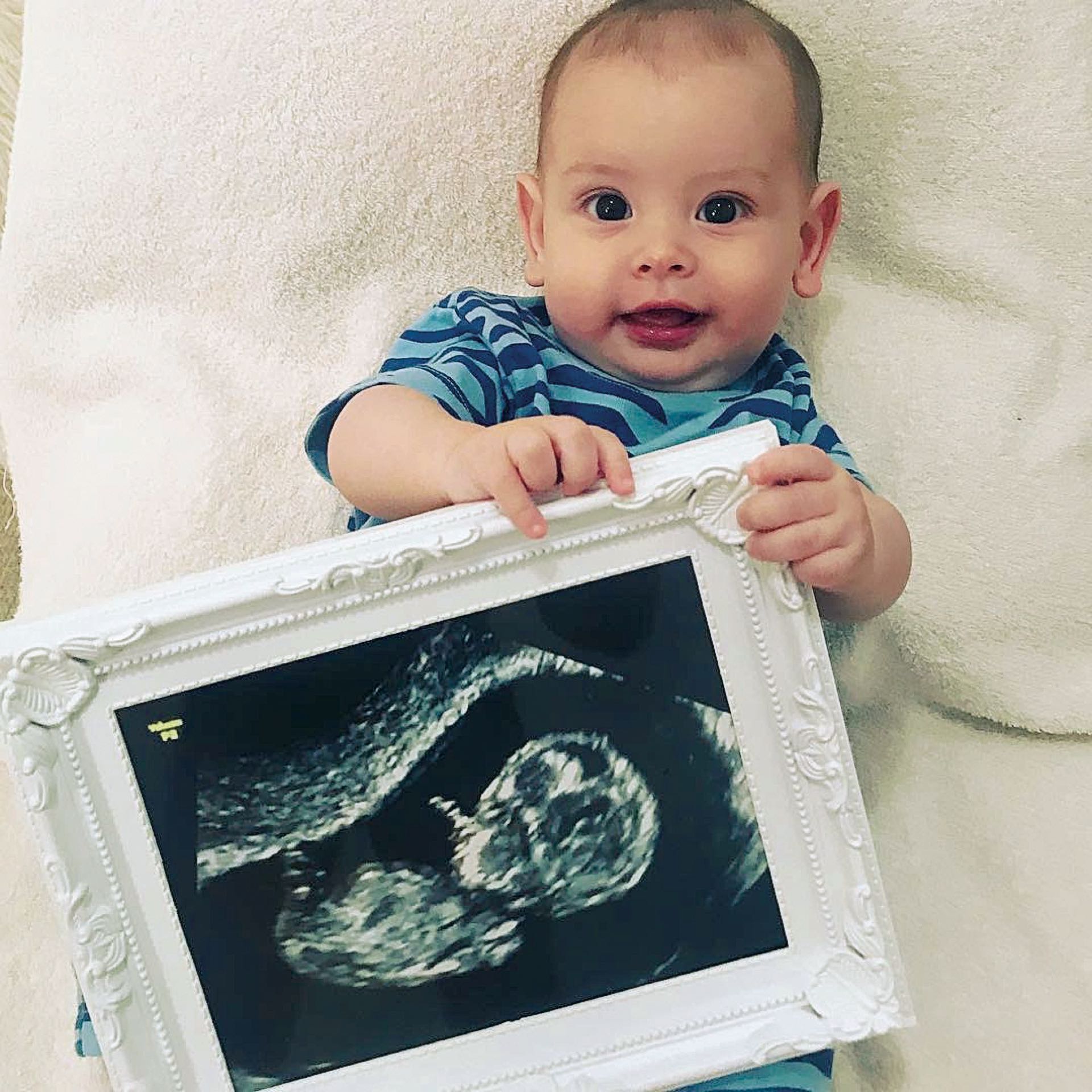 Su sobrino menor, Noah, posa con una ecografía de Dionisio. (Foto álbum personal Flavio Mendoza)