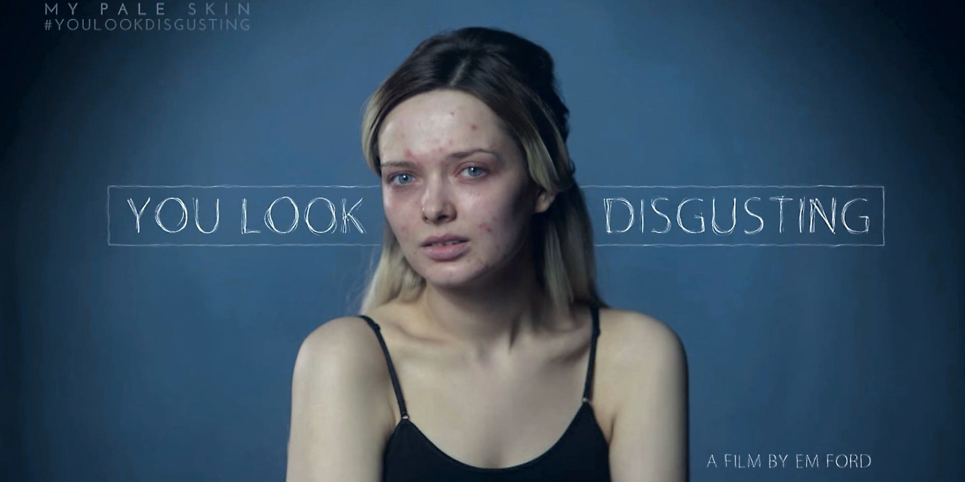 ‘You Look Disgusting’ es el video que la bloguera Em Ford realizó con la finalidad de crear consciencia sobre el bullying y alentar a las personas que padecen acné a aceptar su propia piel. Está publicado en su canal de YouTube y tiene más de 27 millones de vistas.