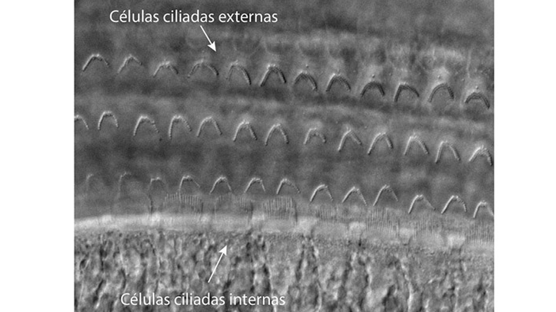 Células ciliadas de la cóclea. Imagen: gentileza investigadores