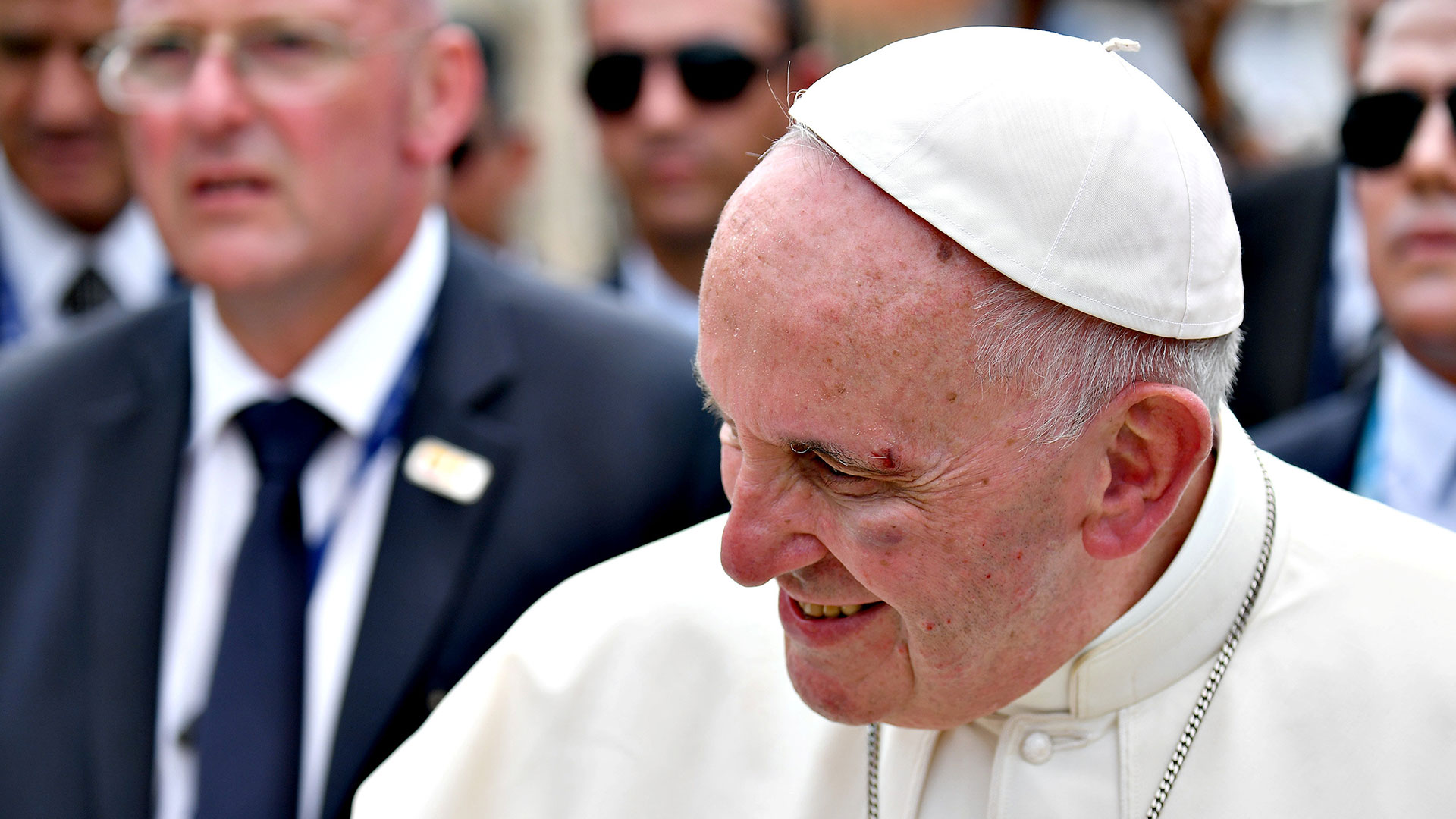 10 de septiembre de 2017: el papa Francisco sufrió un golpe en la cara y sangró al intentar saludar a un niño en Cartagena, Colombia