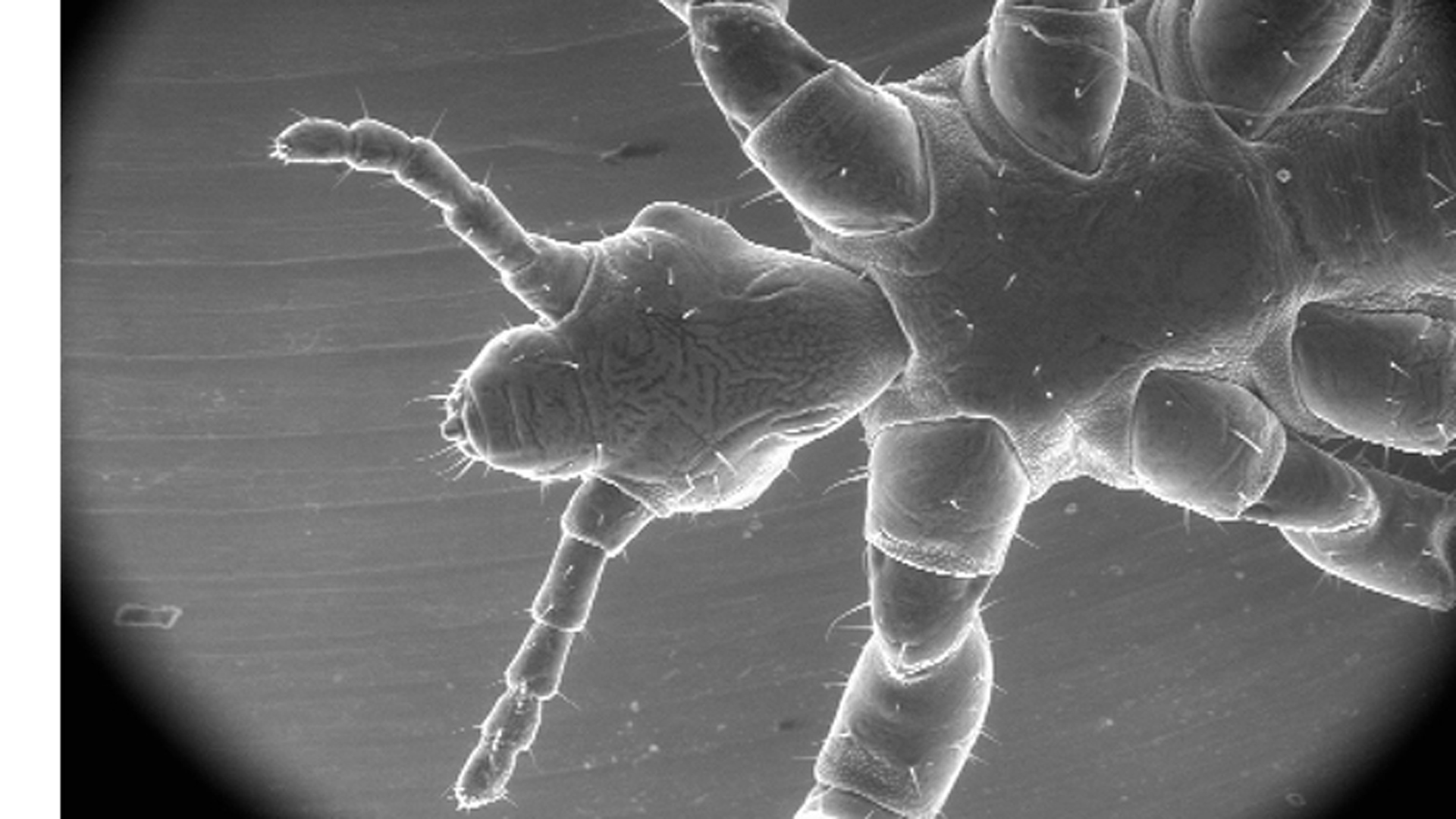 La pediculosis, según varios estudios en América latina, afecta a alrededor de un tercio de los chicos de 3 a 12 años
