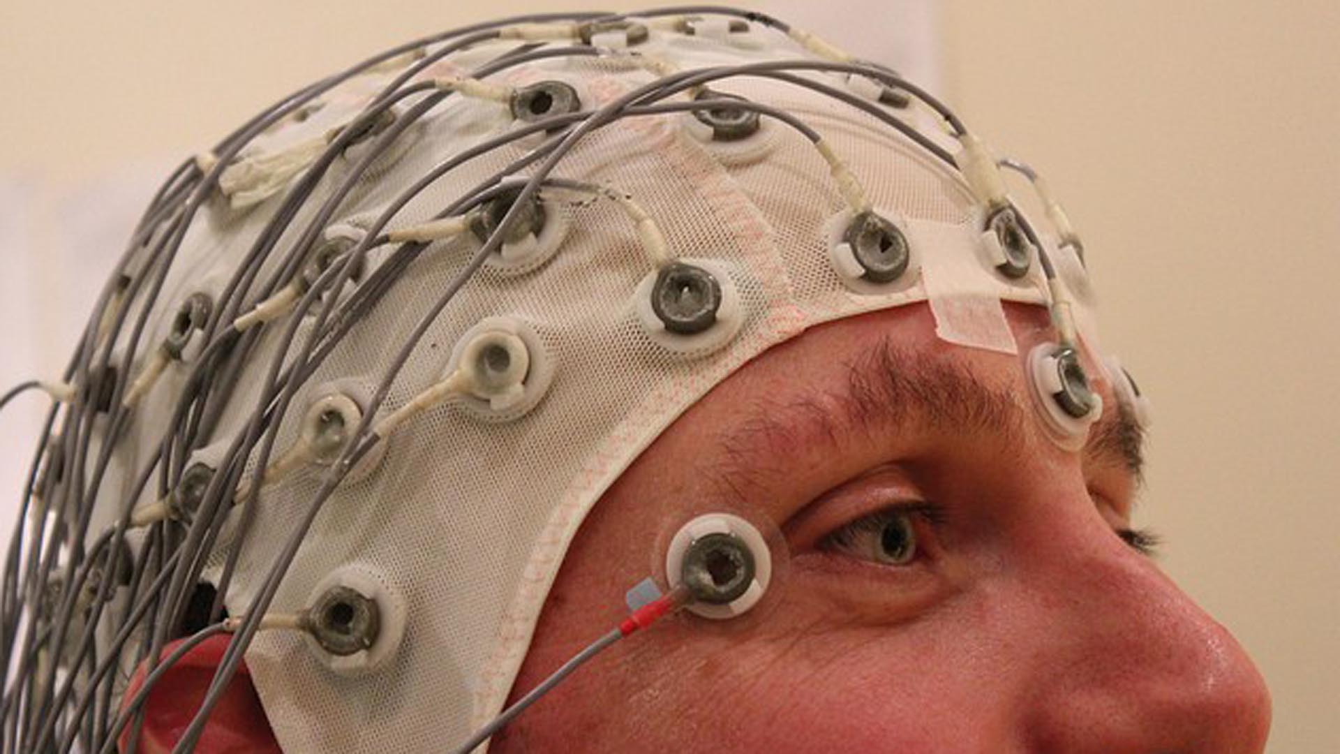 Al estimular la corteza lateral del lóbulo temporal del cerebro, los pacientes podían recordar mejor las palabras