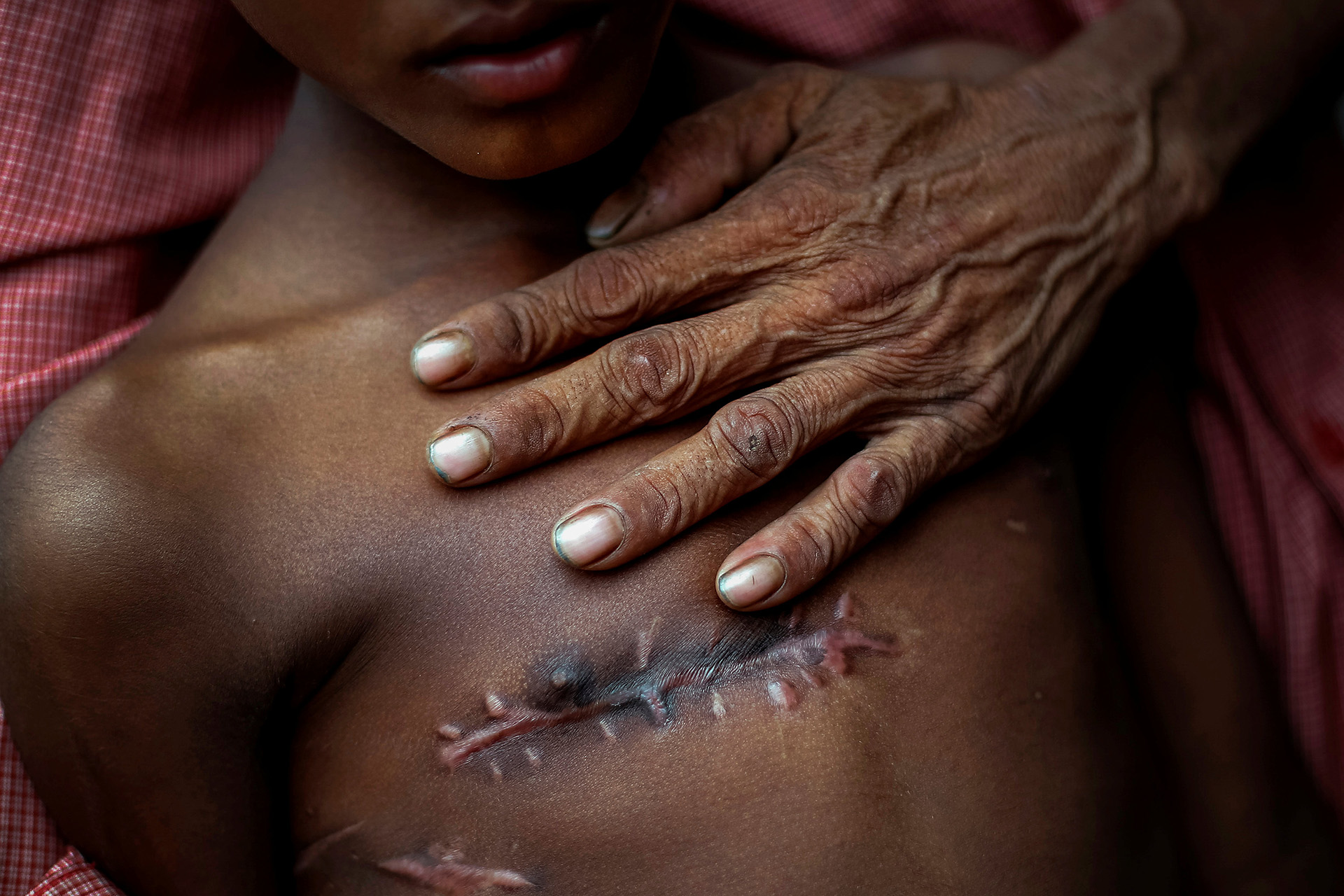 Mohammed Shoaib, de 7 años, quien recibió un disparo en el pecho antes de cruzar la frontera con Myanmar en agosto, es retenido por su padre frente a un centro médico cerca de Cox’s Bazar, Bangladesh, el 5 de noviembre de 2017. (Adnan Abidi)
