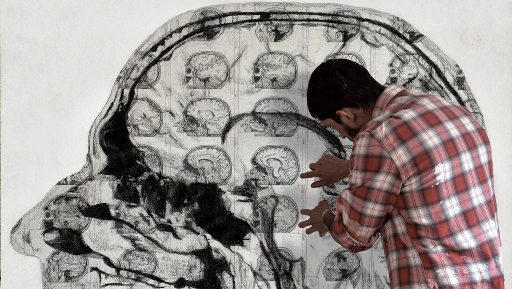 CONSEQUENTIS - LEONARDO BLANC BR