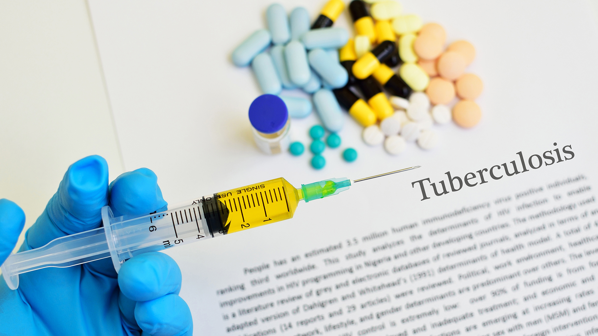 Es fundamental la aplicación de la vacuna BCG al nacer, como única dosis en la vida, para evitar la aparición de formas graves como meningitis por tuberculosis (Getty Images)