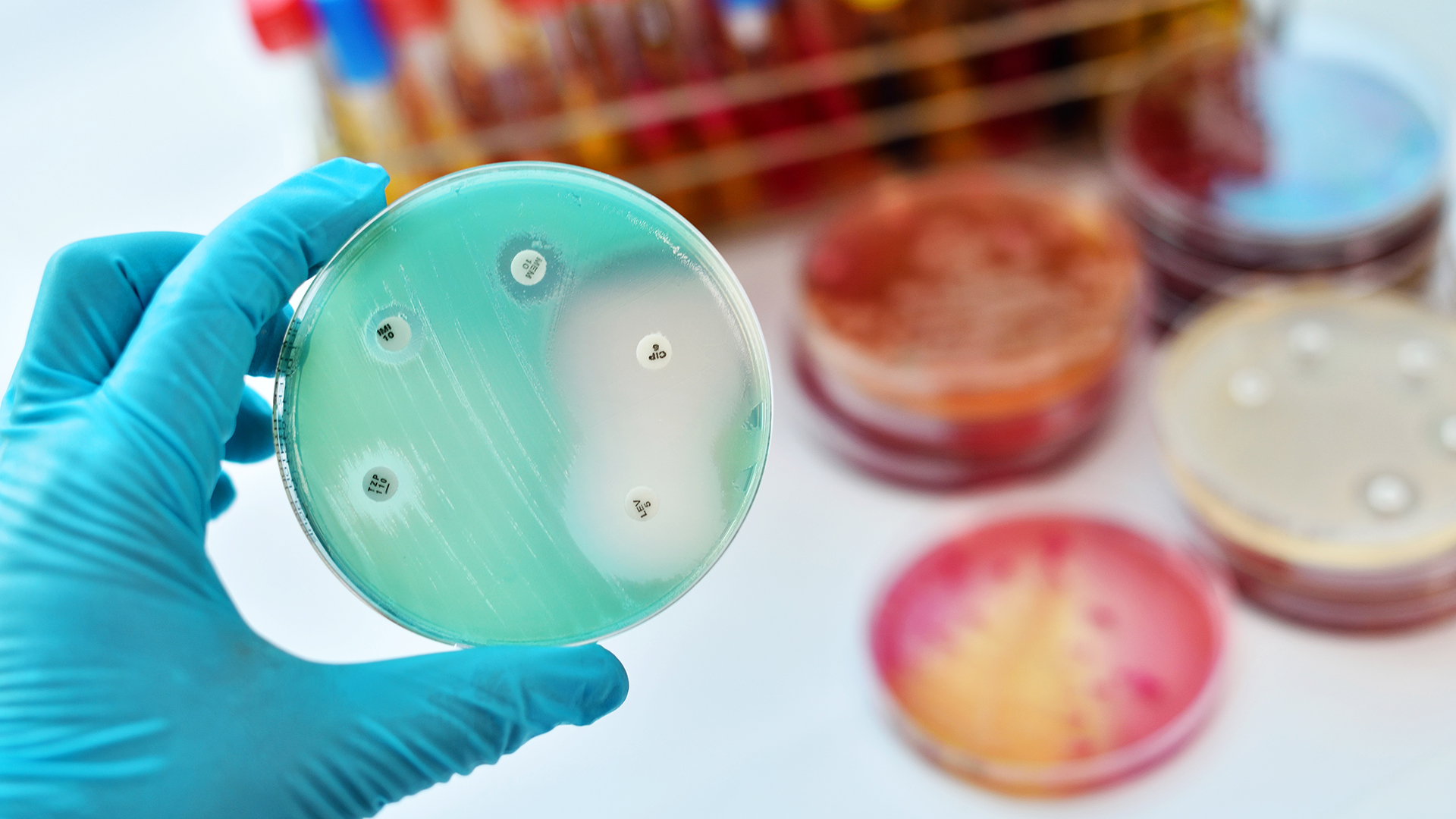 El mayor número de infecciones provocadas por estas bacterias se presenta en los pacientes que están hospitalizados en unidades de cuidados intensivos, aunque ya se observan fuera del hospital (Getty)