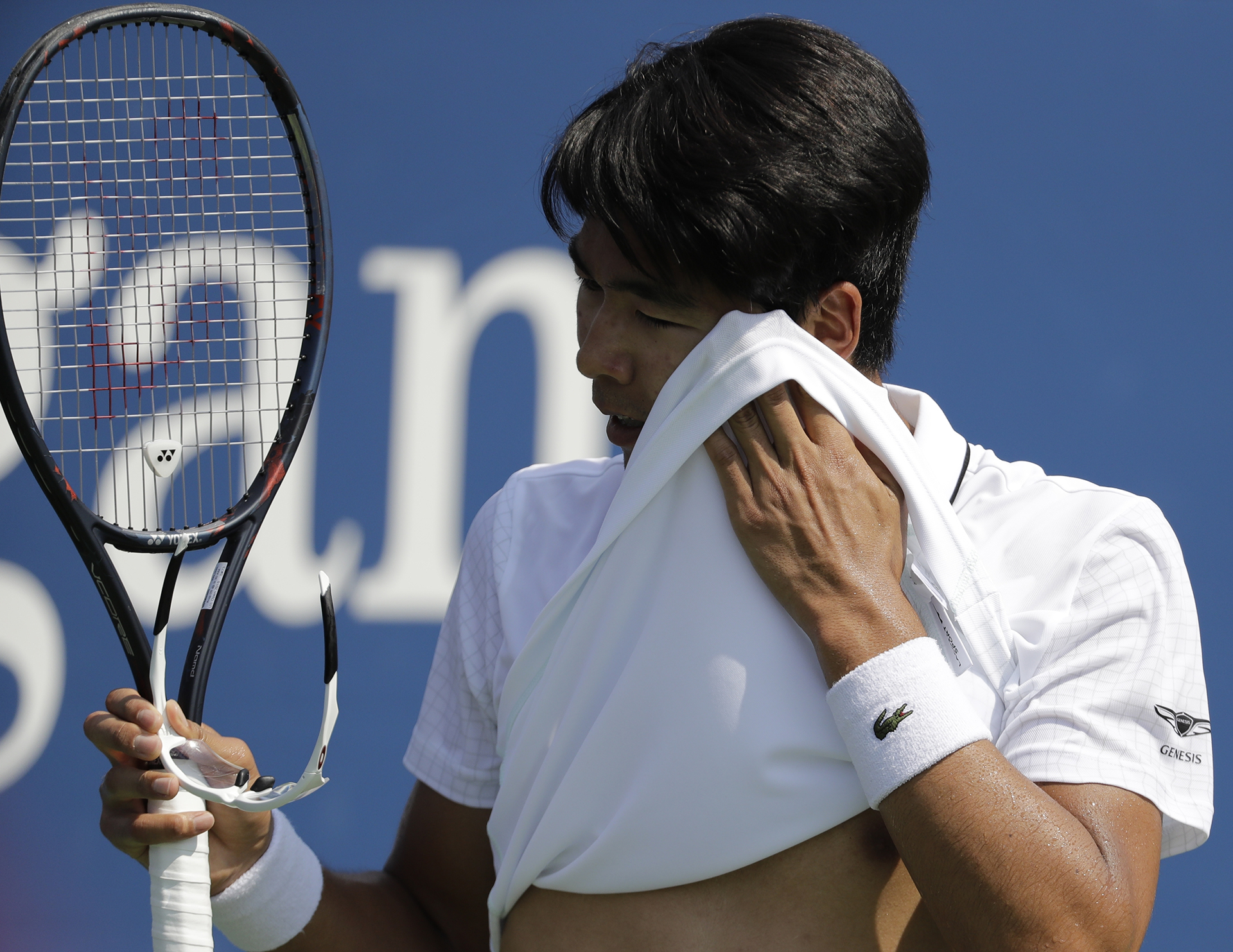 El surcoreano Hyeon Chung fue uno de los afectados