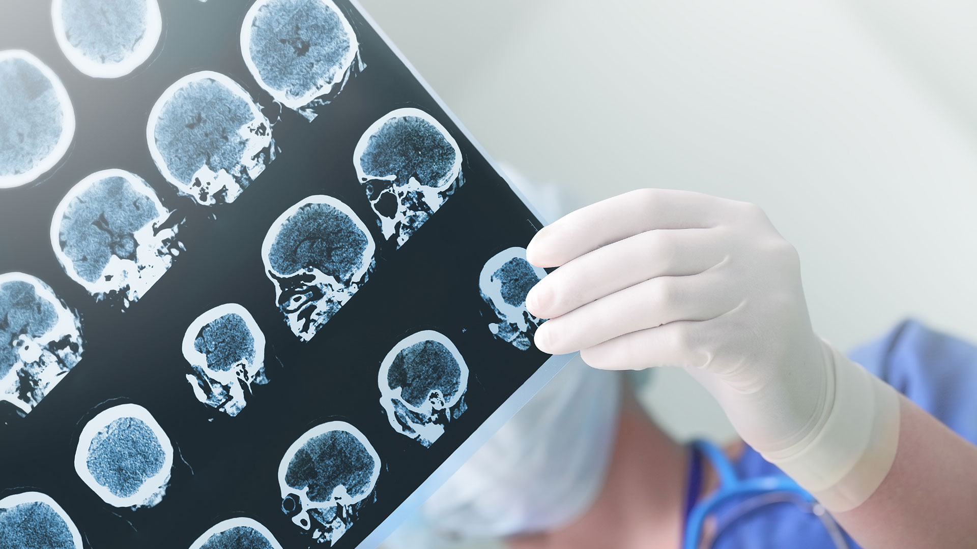 Se encuentran en curso múltiples investigaciones intentando encontrar drogas que modifiquen la enfermedad (Getty)