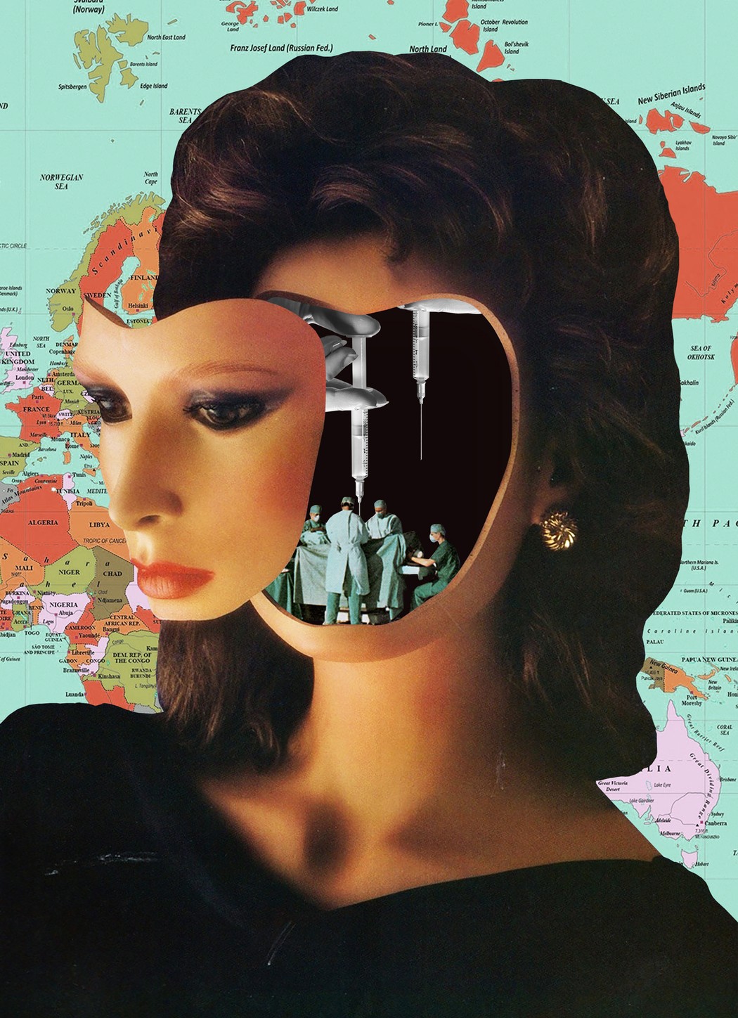 Los levantamientos faciales son un gran negocio en determinados sectores de la industria viajera. Ilustración: Blake Kirpes