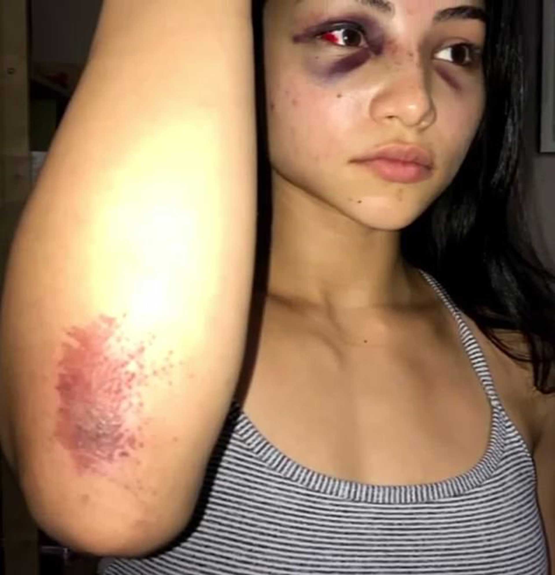 Así quedó la joven después de al golpiza