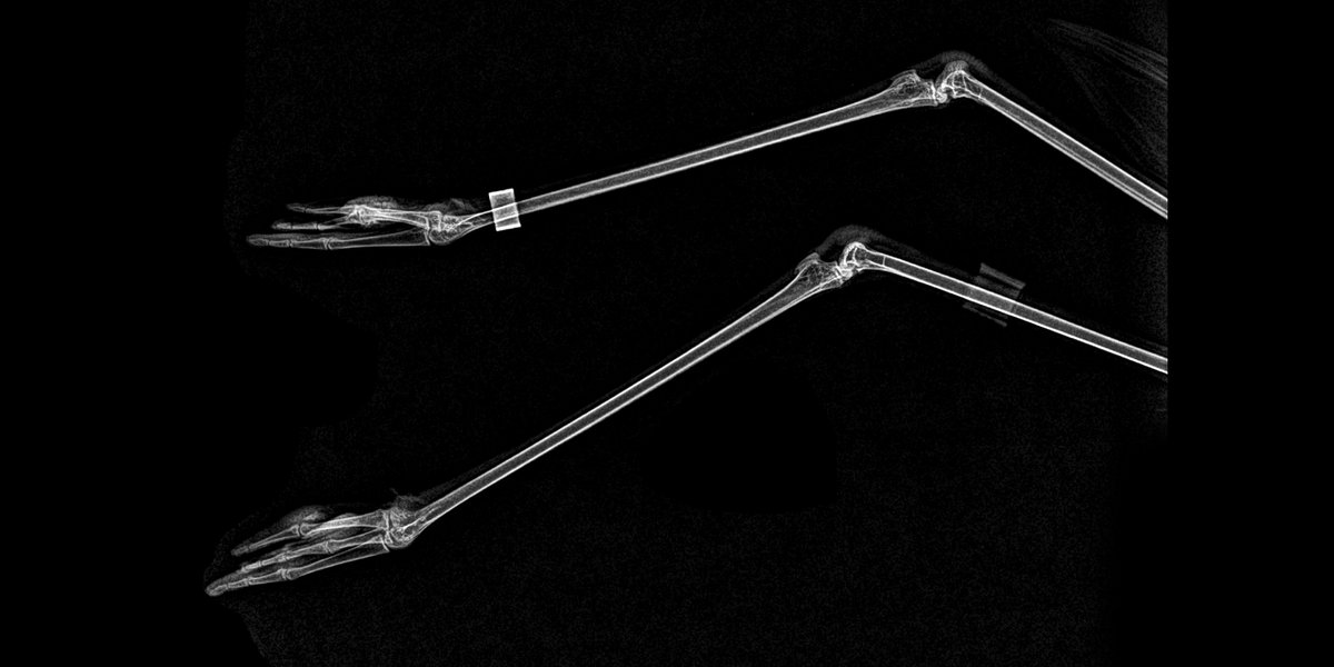 Patas de flamingo.