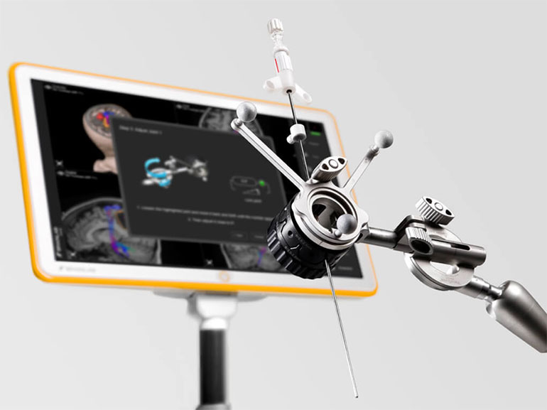 Sistema de localización intraoperatorio BrainLab (Foto: Investigación The Implant Files)