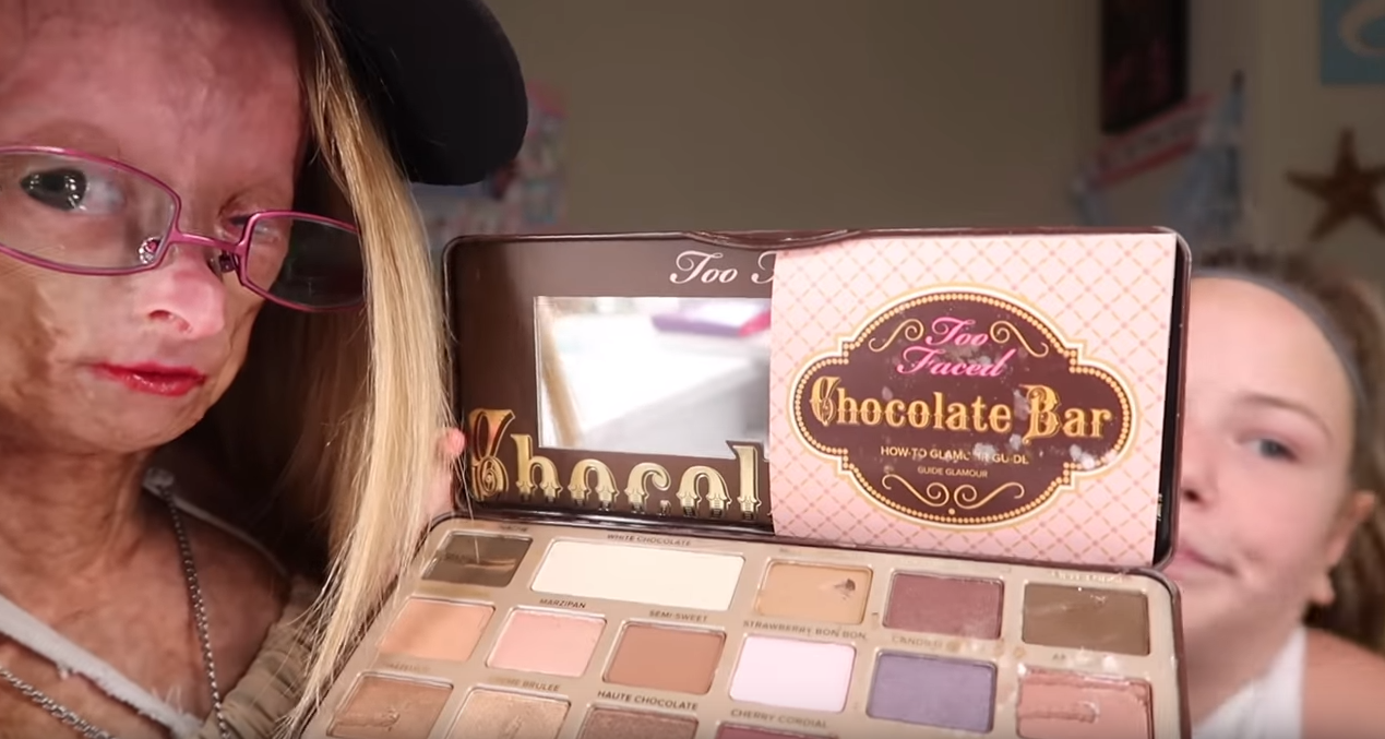 Adalia Rose, la pequeña youtuber con envejecimiento prematuro que conquistó  a millones de seguidores - Infobae, image size:1269x677