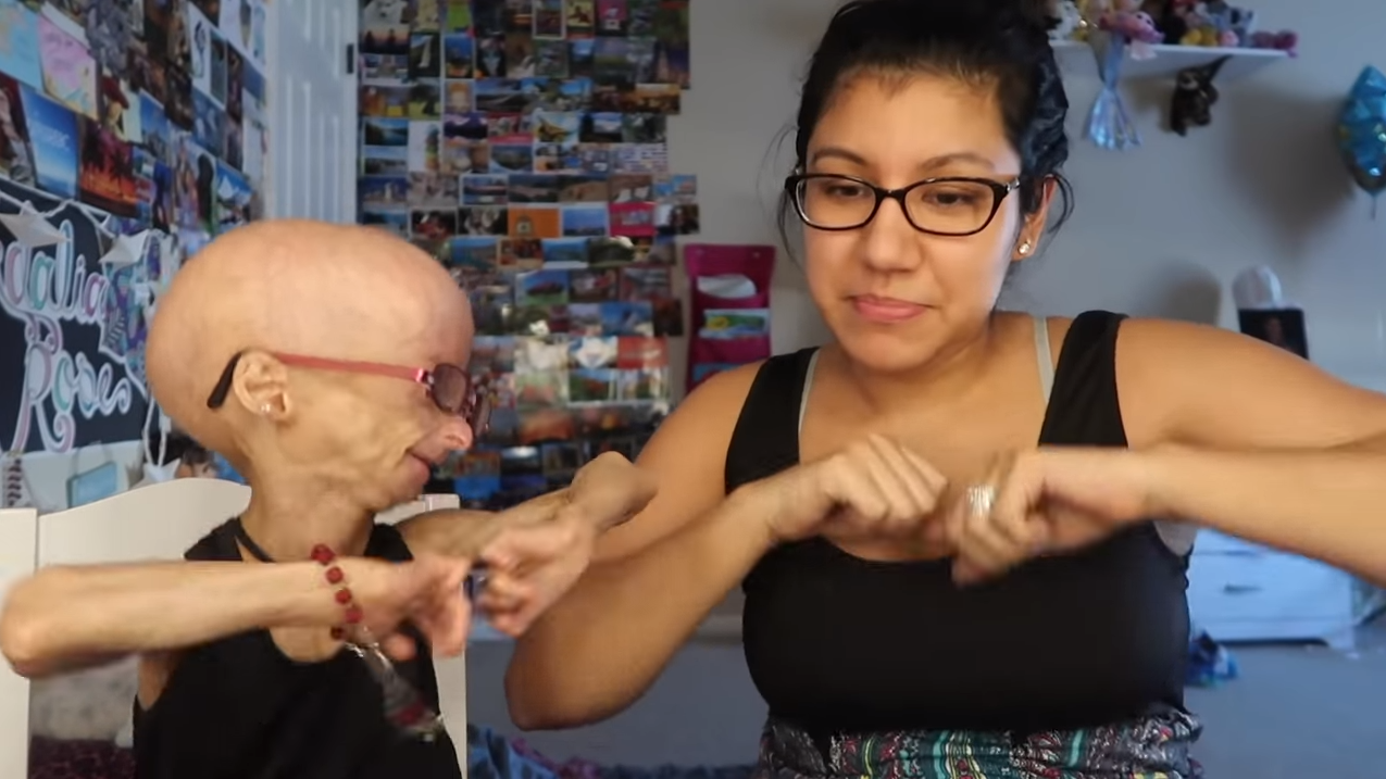 Adalia Rose, la pequeña youtuber con envejecimiento prematuro que conquistó  a millones de seguidores - Infobae, image size:1275x717