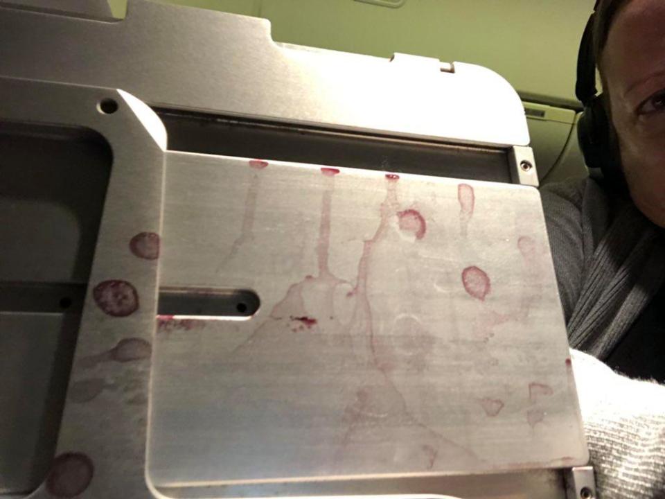 Además de las manchas, el servicio de entretenimiento a bordo no funcionaba (Foto: @LexLax1)