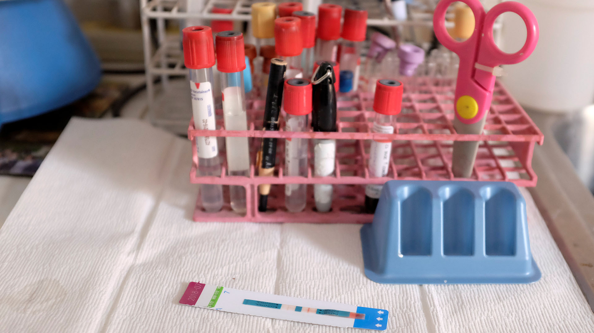 Una prueba del VIH muestra un resultado positivo en el laboratorio de la ONG “Acción Solidaria”