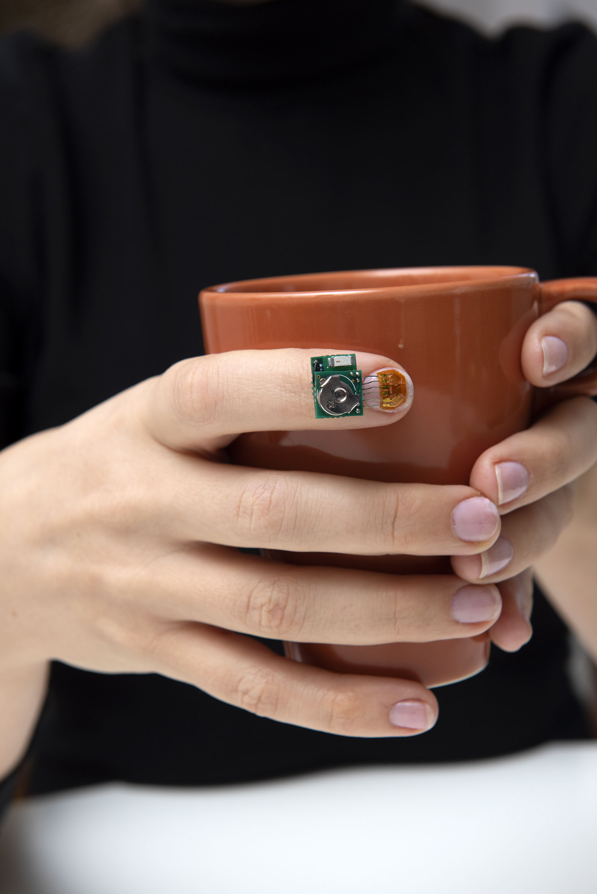 IBM dio a conocer un sensor para las uñas que monitorea los movimientos de la mano y apunta a ayudar a las investigaciones sobre el Parkinson.