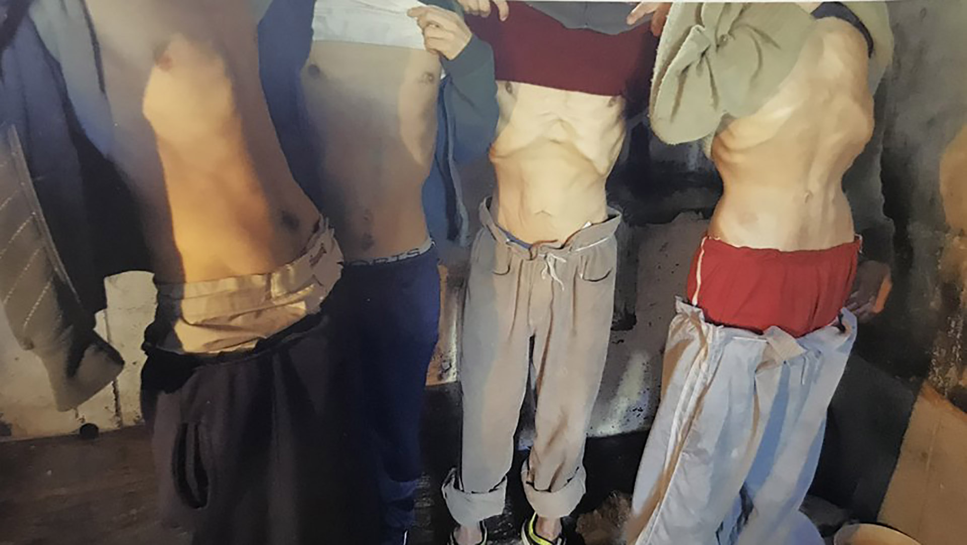 Presos desnutridos en COMCAR