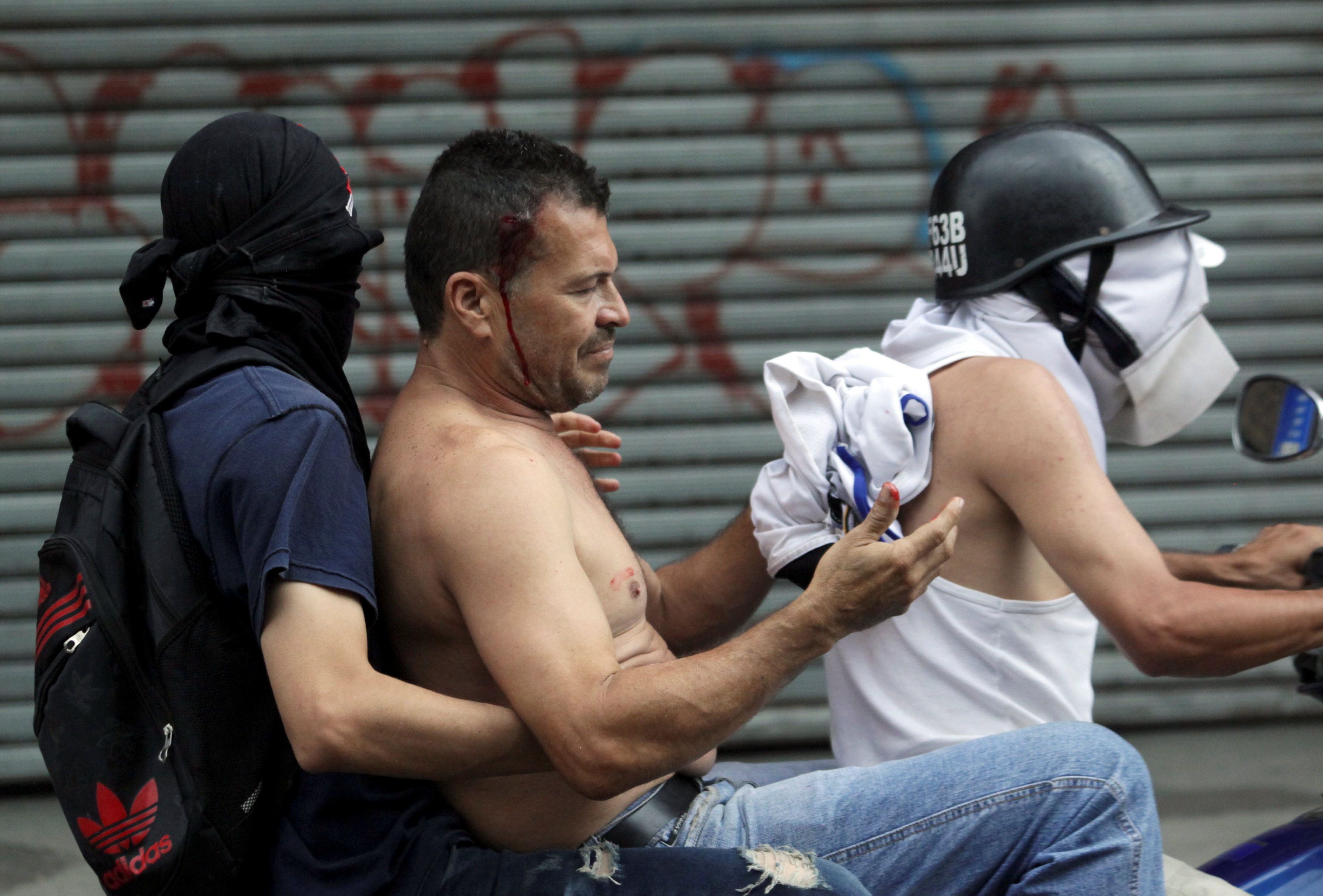 Un hombre herido por las fuerzas chavistas es asistido por compañeros en el Tachira, Venezuela. (REUTERS/Carlos Eduardo Ramirez)