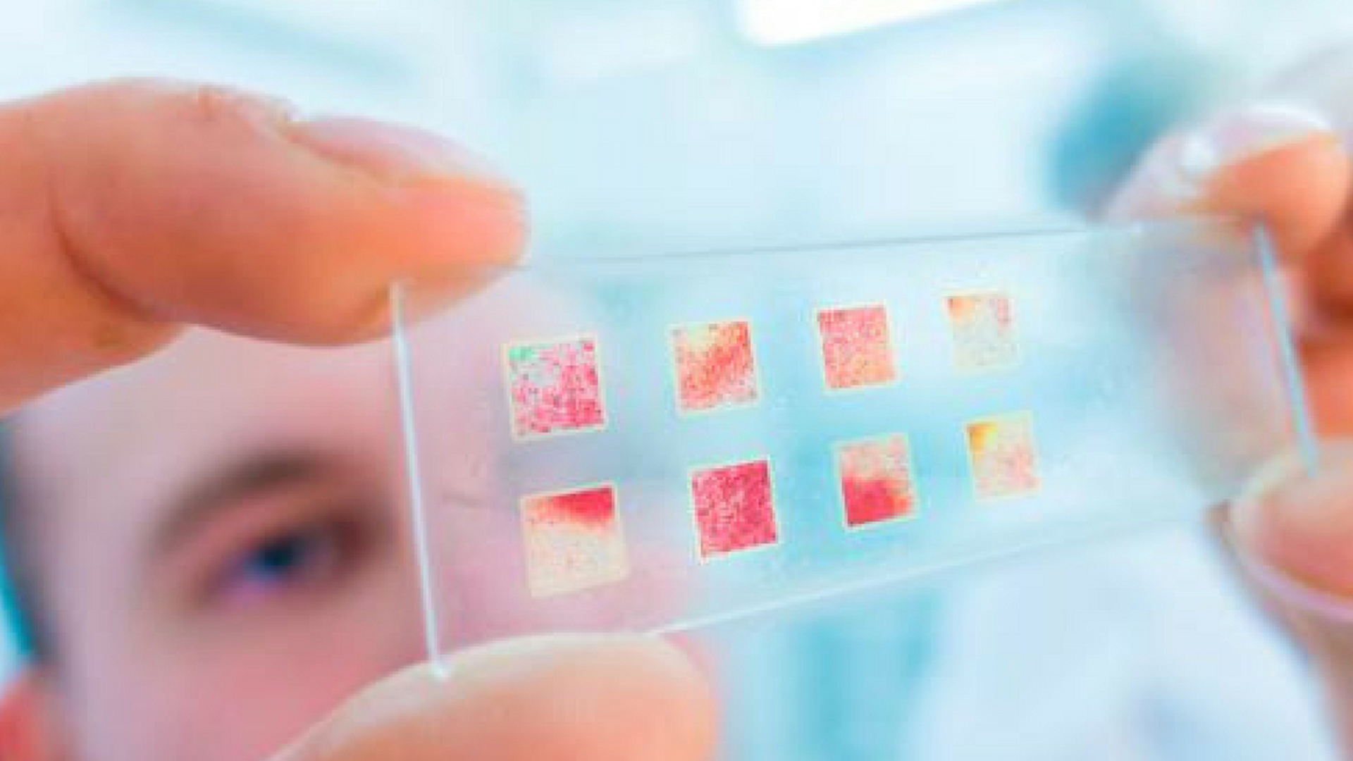 Cada vez hay más avances contra el cáncer